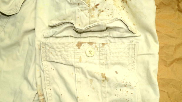 Những vết máu dính trên quần của Dustin Parra. Ảnh: CBS